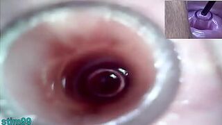 Lesbians Extreme Cervix Play and Peehole Fucking Penis Dildo - porn video